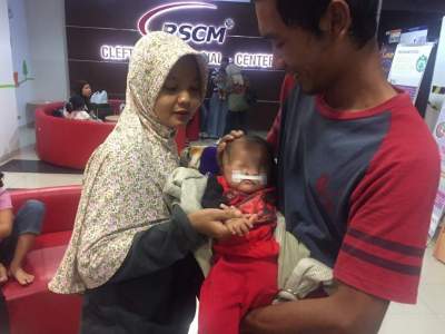 Dinkes Bantah Persulit Pengobatan Pasien Tanpa Kelopak Mata