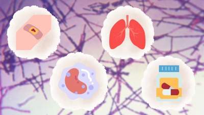 Waspada! Kemenkes Minta Masyarakat Memperhatikan Empat Tipe Antraks pada Manusia, Termasuk Antraks Paru-Paru