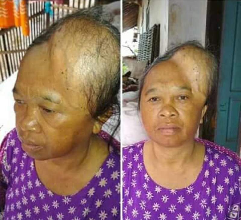 Warga Miskin Sawarna Idap Penyakit Aneh