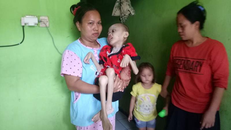 Ardiansyah penderita Hydrocephalus di Kecamatan, Karawaci, Kota Tangerang