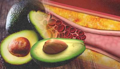 Buah alpukat yang dapat menurunkan kadar kolestrol, (Foto: Getty Images/Westend61, Liputan6) Ilustrasi: Aqila/db