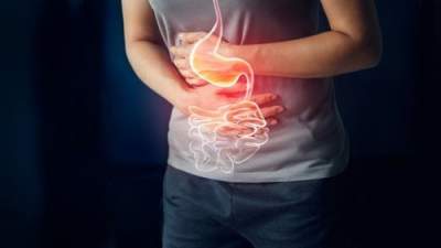 Ilustrasi asam lambung naik. (istock)